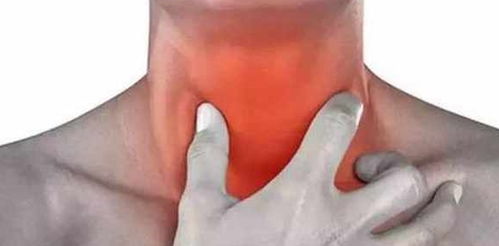 咽喉炎可以吃三拗片吗(三拗片嗓子疼能吃吗)