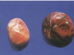 葡萄状疣图片(葡萄状肉瘤的临床表现)